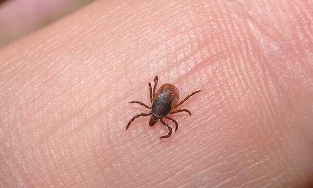 Co zrobić żeby nie złapać wszy?